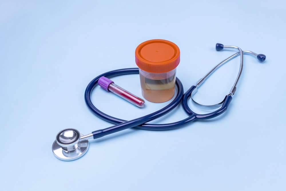 Ett stetoskop, en burk urin och ett provrör med blod för analys